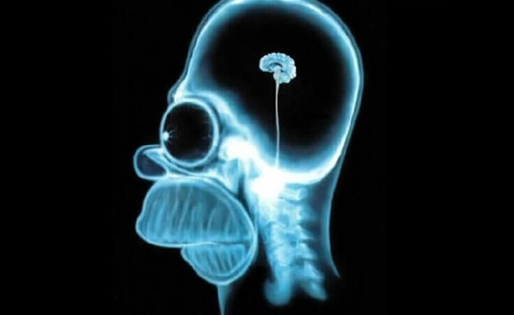 This image can be found all over the web by searching for images using the search phrase: xray of Homer Simpson brain