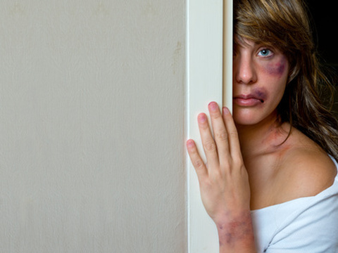 Woman with bruises (Credit: bertys30 via Fotolia)