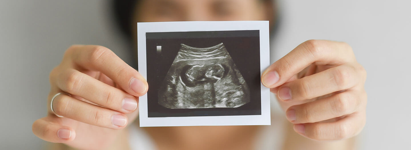 A woman holds up an ultrasound of a preborn baby in front of her face