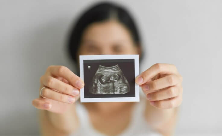 A pregnant woman shows her ultrasound to the camera. © By eggeeggjiew/stock.adobe.com