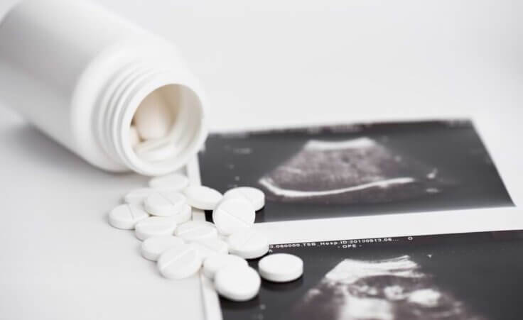 Abortion pills spilled onto a sonogram