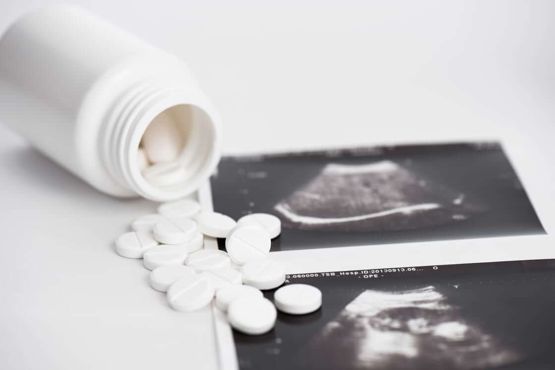Abortion pills spilled onto a sonogram