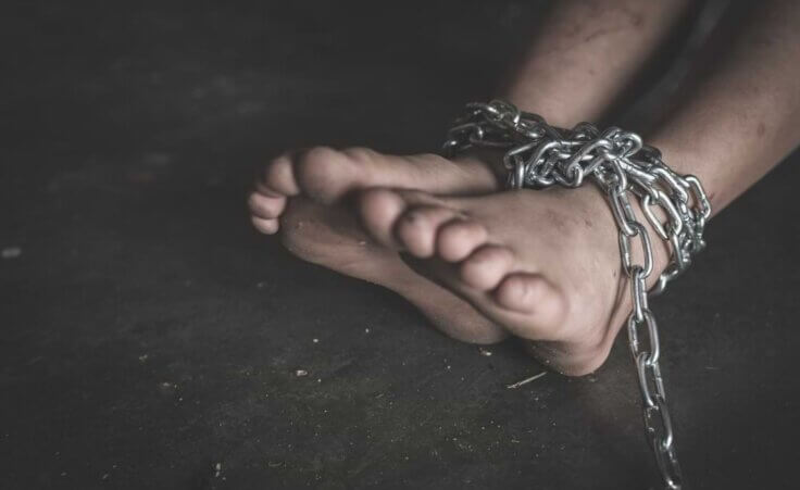 Child's dirty feet bound with chains.