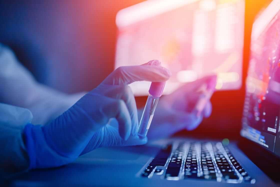 A lab technician wearing blue gloves holds a vial of some chemical substance in front of an open laptop. © Parilov/stock.adobe.com Authorities discovered an unlicensed lab in Fresno County, California, where the CDC found at least twenty potentially infectious agents.