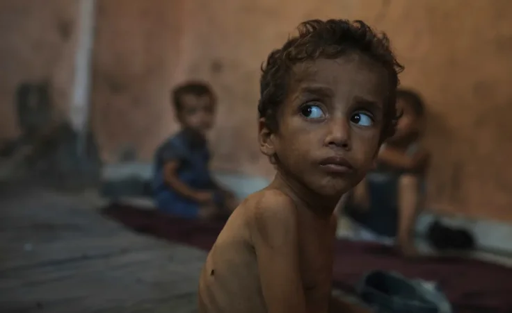 Yazan Abu Ful, a 2-year-old malnourished child, sits at his family home in the Shati refugee camp in Gaza City on Wednesday, July 23, 2025. (AP Photo/Jehad Alshrafi) Witkoff and Huckabee visit aid operation in Gaza